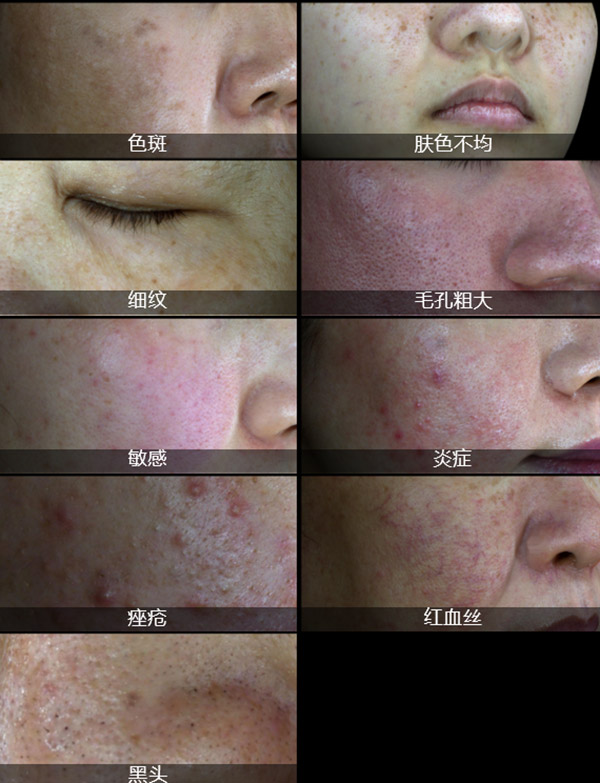 医用皮肤镜什么牌子好医美小课堂 ｜ 美际M2皮肤镜_https://www.jmylbn.com_新闻资讯_第3张